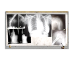 X-Ray Light Box - BioShock 2