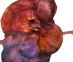 Engorged Zombie - Dark Souls